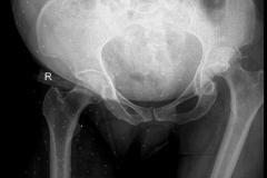 xray13a