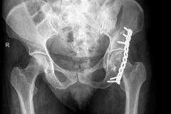 xray14